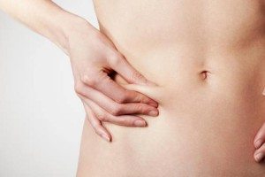 Exercises to Get Rid of Stretch Marks