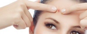 Quick Fixes to Get Rid of Your Forehead Acne